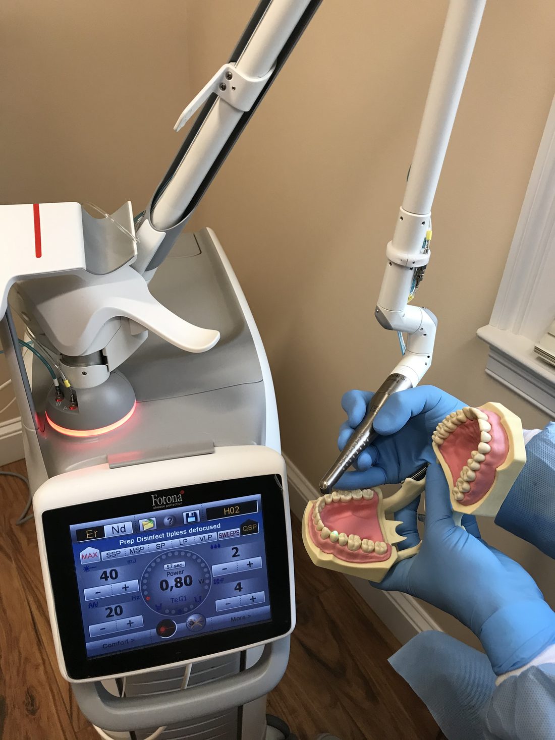 Fotona dental laser console and handpiece used for gum and soft-tissue procedures at Stratford Dental Care